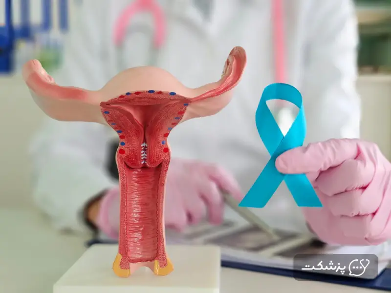 آناتومی سرطان تخمدان