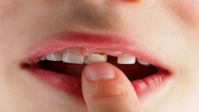 چگونه دندان های لق را تقویت کنیم؟ || پزشکت
