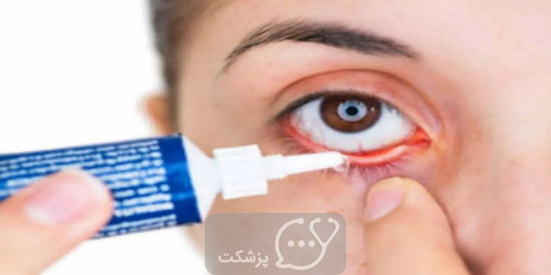پماد چشمی اریترومایسین || پزشکت