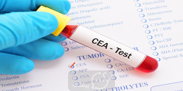 تست CEA آنتی ژن کارسینومبریونیک || پزشکت