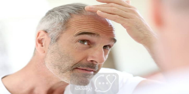 خودارضایی باعث ریزش مو می شود؟ || پزشکت