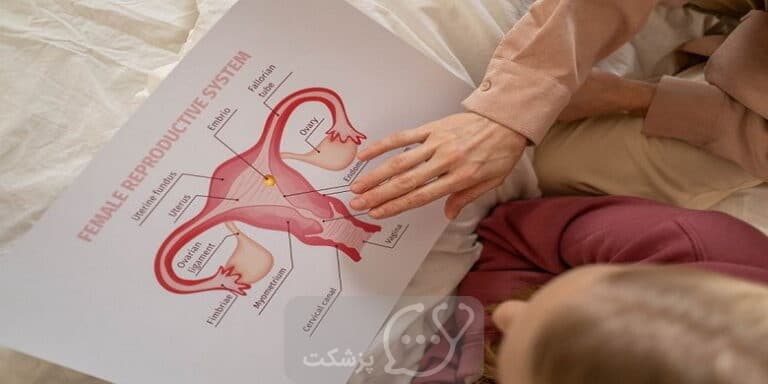 پرده بکارت چیست؟ || پزشکت