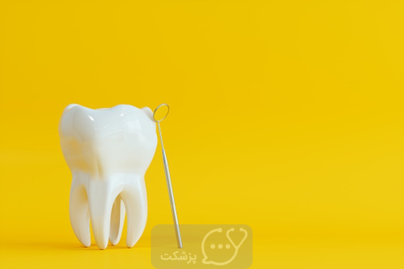 دندان های شفاف-پزشکت
