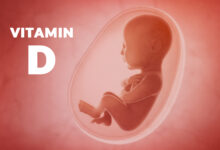 ویتامین دی و سقط جنین || پزشکت