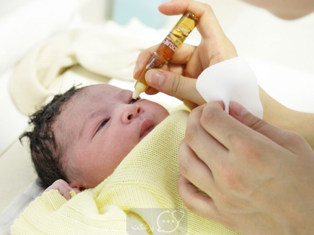 درمان آنتی بیوتیکی چشم نوزاد|| پزشکت