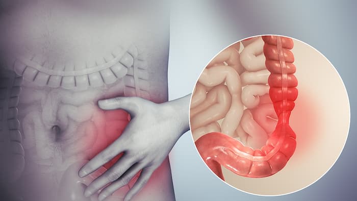 IBS و درد سمت راست شکم-پزشکت