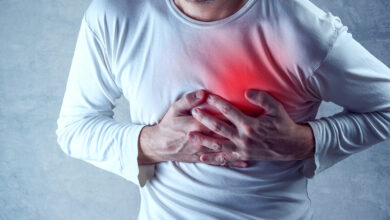 حمله قلبی|| پزشکت