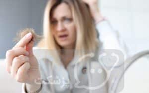یائسگی و ریزش مو | پزشکت