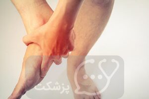 شکستگی لیسفرانک ||پزشکت