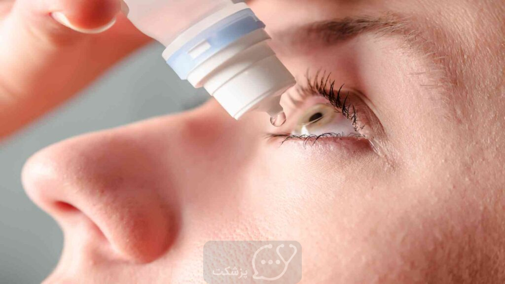 شستشوی چشم با اسید بوریک || پزشکت