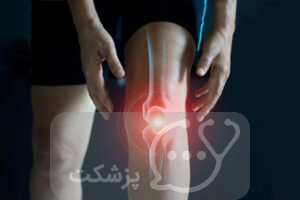 آرتریت روماتوئید || پزشکت