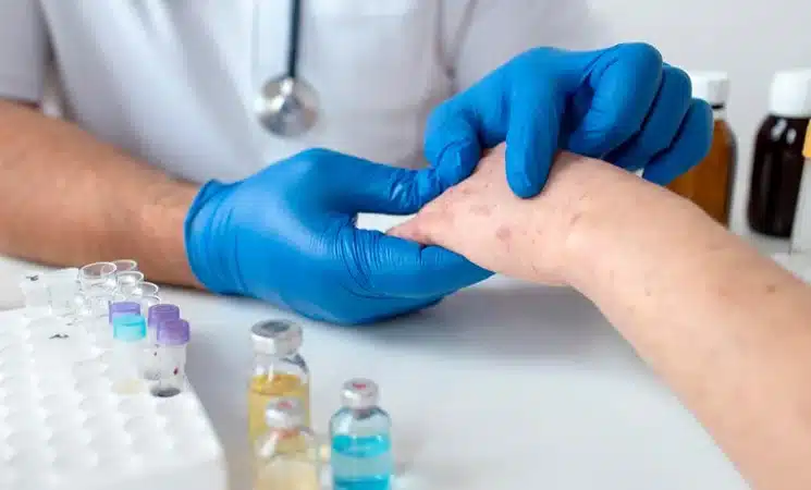 درمان آلرژی پوستی | پزشکت