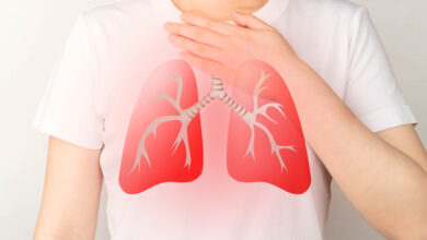 COPD|| پزشکت