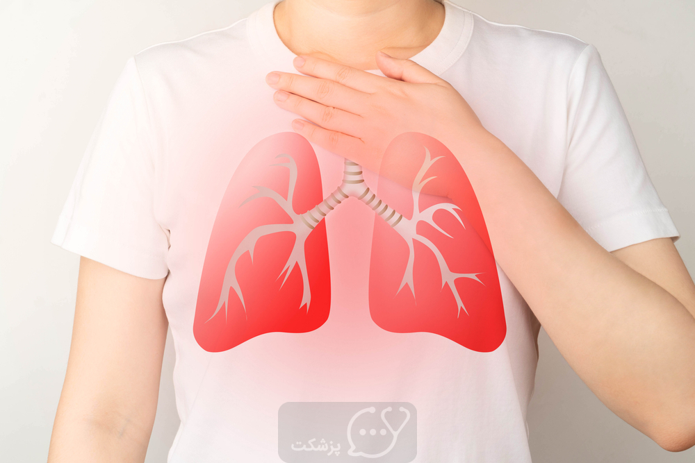 COPD|| پزشکت
