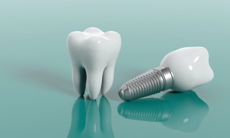 جراحی ایملنت دندان || پزشکت