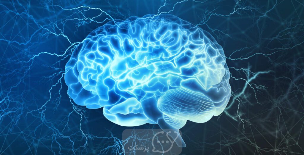 احساس شوک الکتریکی در مغز || پزشکت