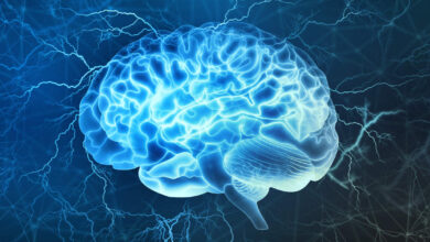 احساس شوک الکتریکی در مغز || پزشکت