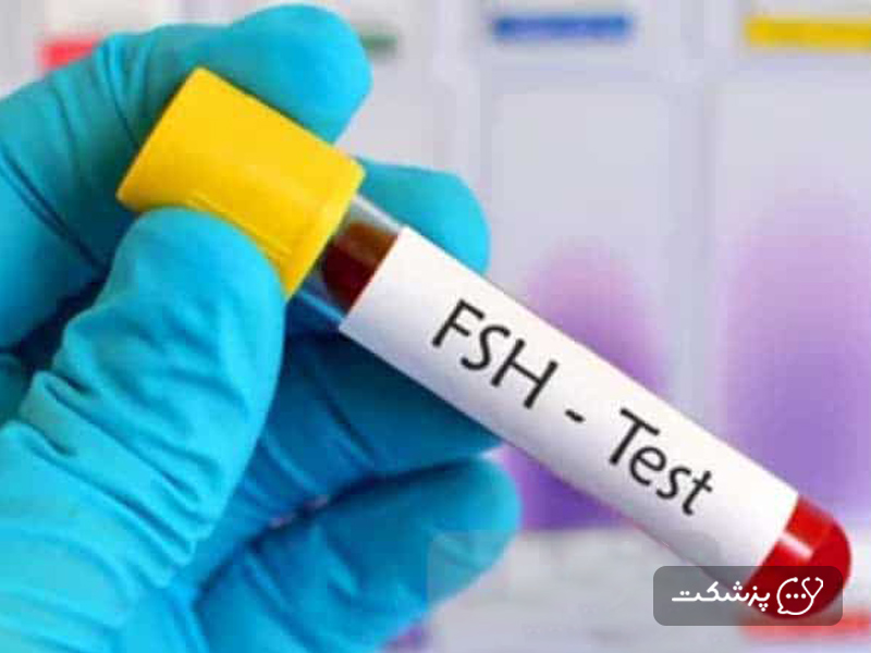 آزمایش خون برای تعیین سطح FSH