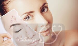 اعتماد به نفس چهره || پزشکت