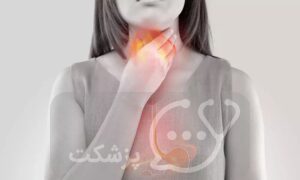 رفلاکس حنجره || پزشکت