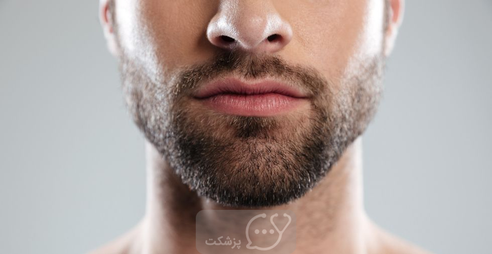 DHT و رشد مو صورت || پزشکت