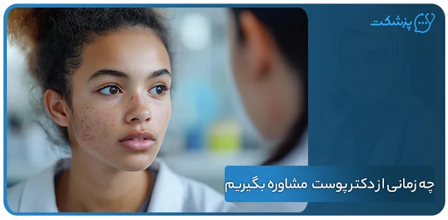 چه زمانی باید از دکتر پوست آنلاین مشاوره بگیریم؟ | پزشکت