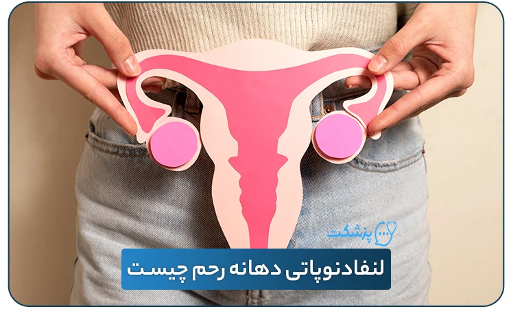لنفادنوپاتی دهانه رحم | پزشکت