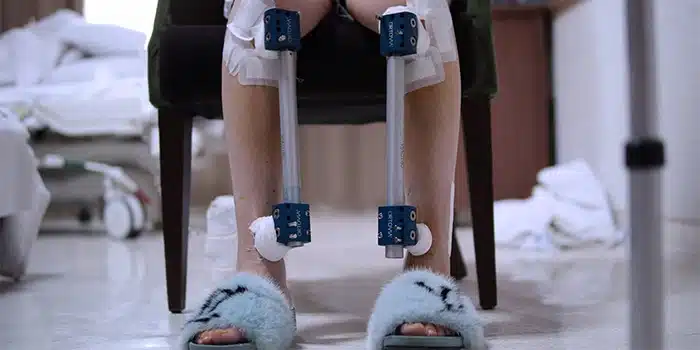 تجربه واقعی افرادی که جراحی افزایش قد رو انجام دادن