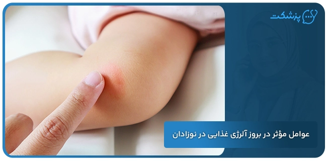 عوامل مؤثر در بروز آلرژی غذایی در نوزادان | پزشکت