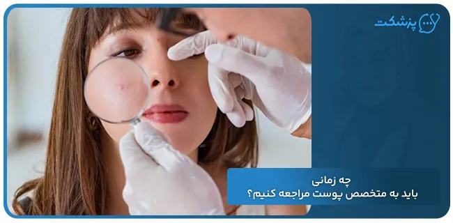 چه زمانی باید به متخصص پوست مراجعه کنیم | پزشکت
