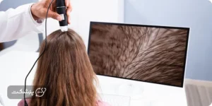 دکتر آنلاین مو برای ریزش مو بعد زایمان | پزشکت