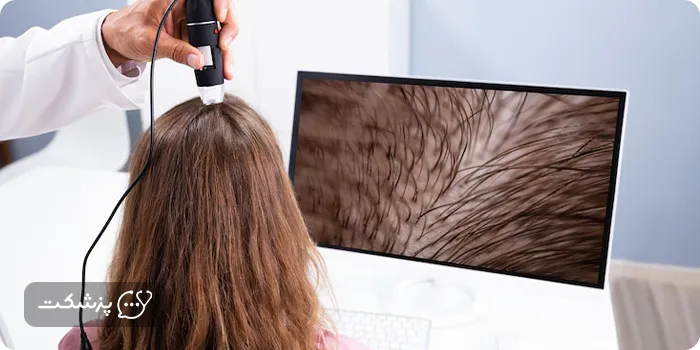 دکتر آنلاین مو برای ریزش مو بعد زایمان | پزشکت