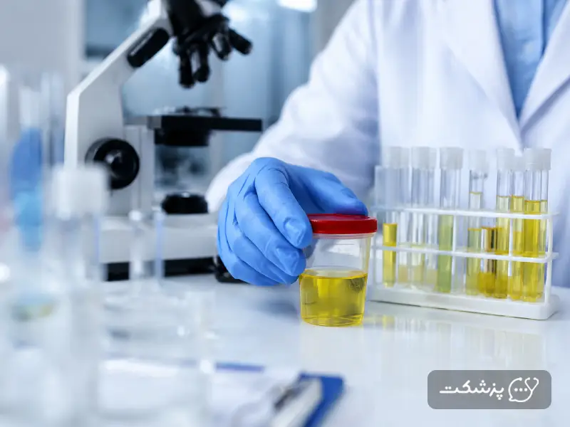 تست ادرار در آزمایشگاه