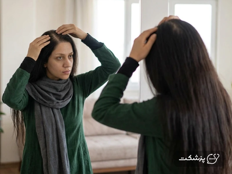 تفاوت ریزش مو در زنان و مردان - پزشکت