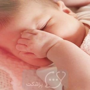 مالش چشم های کودک | پزشکت