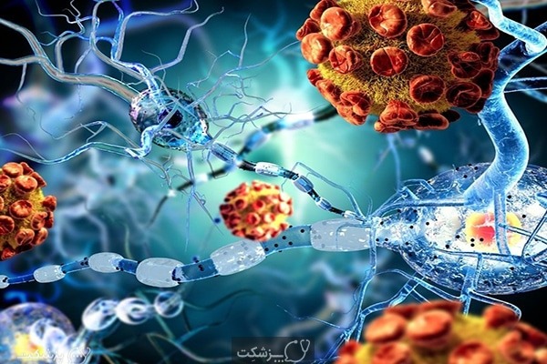 بیماری های خود ایمنی | پزشکت