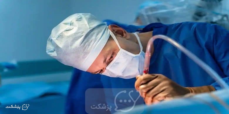 اسفنکتروتومی یا جراحی شقاق || پزشکت