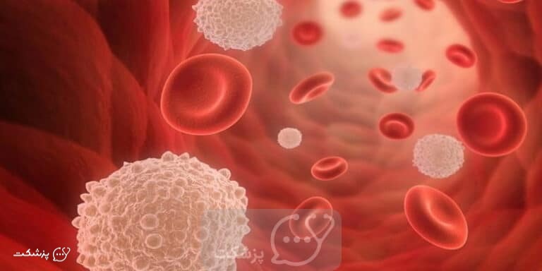 سطح مونوسیت بالا | پزشکت