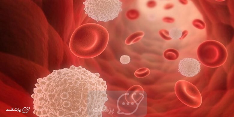 سطح مونوسیت بالا | پزشکت