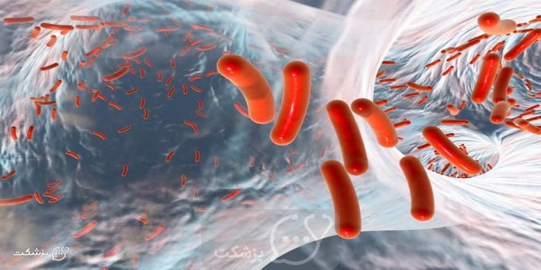 تست آنتی استرپتولیزین O چیست؟ || پزشکت