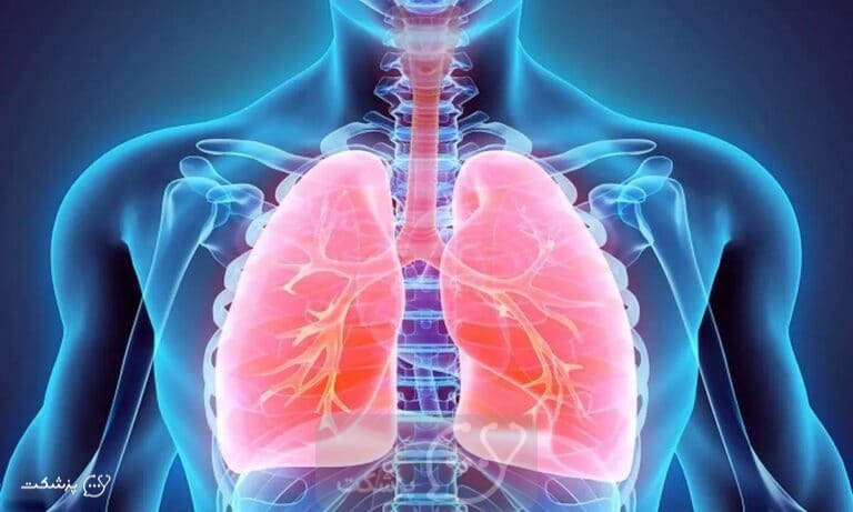 اسیدوز تنفسی|| پزشکت