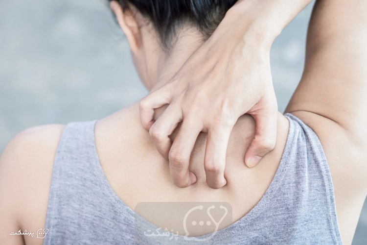 آیا سرطان باعث خارش می شود؟ || پزشکت