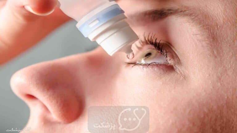 شستشوی چشم با اسید بوریک || پزشکت