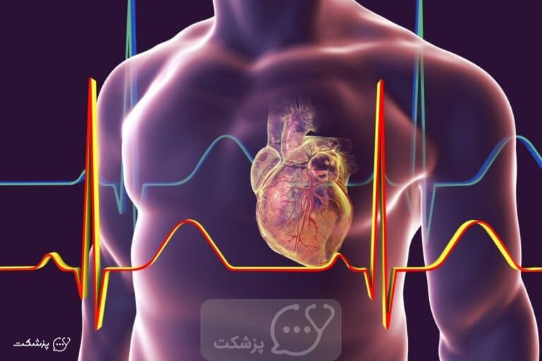 ناهماهنگی بطنی || پزشکت