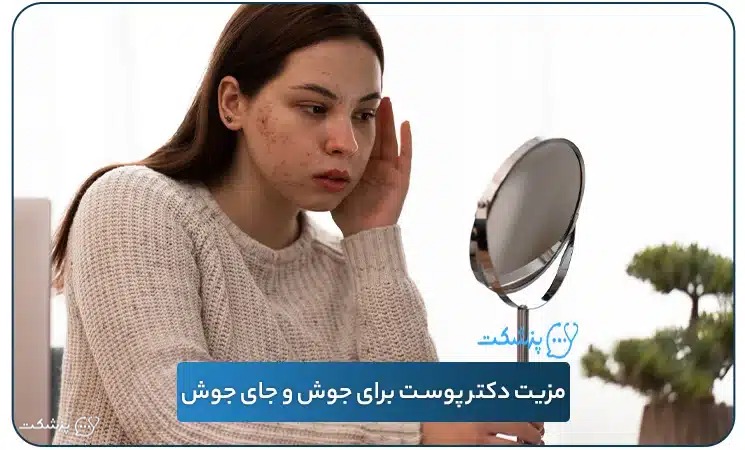دکتر پوست آنلاین برای جوش | پزشکت